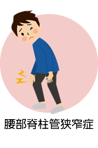 腰部脊柱管狭窄症