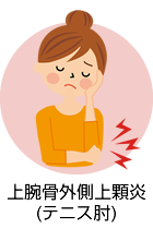 上腕骨外側上顆炎